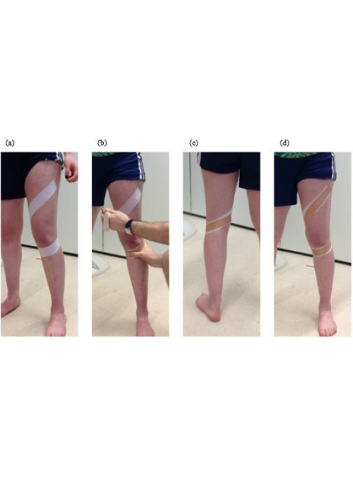 Tape McConnell P... 2