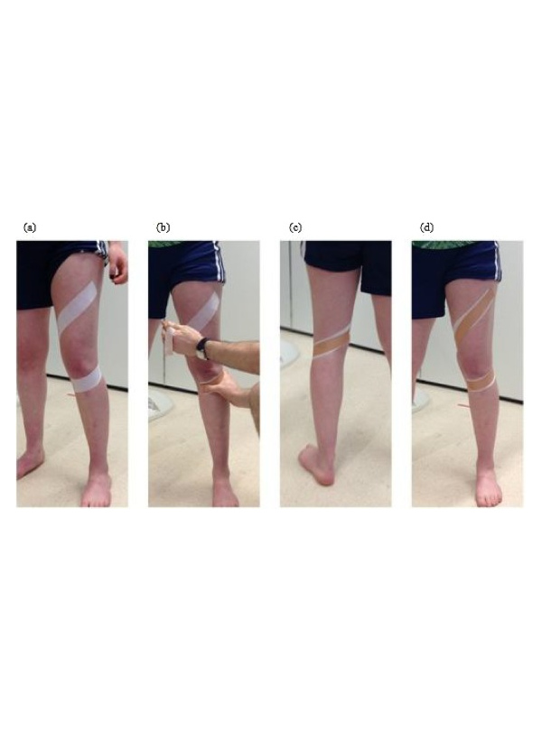 Tape McConnell P Fisioportunity