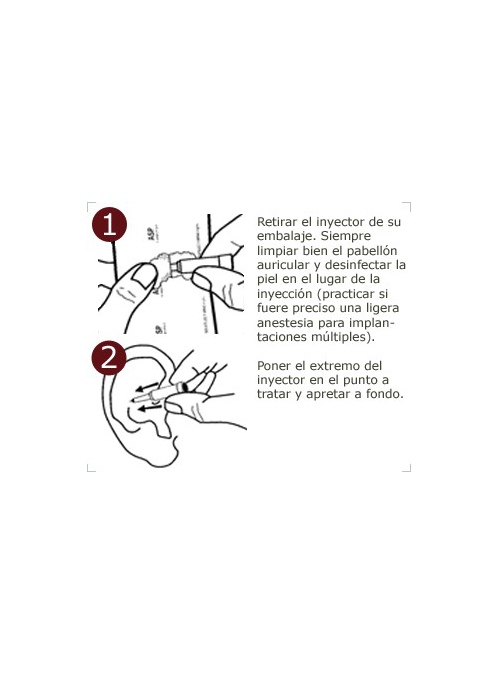 Agujas auriculoterapia acero inoxidable ASP 2